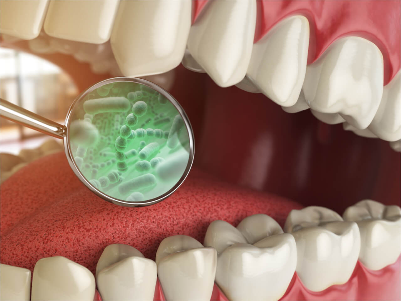 Things You Need to Know about Tooth Infection Sepsis