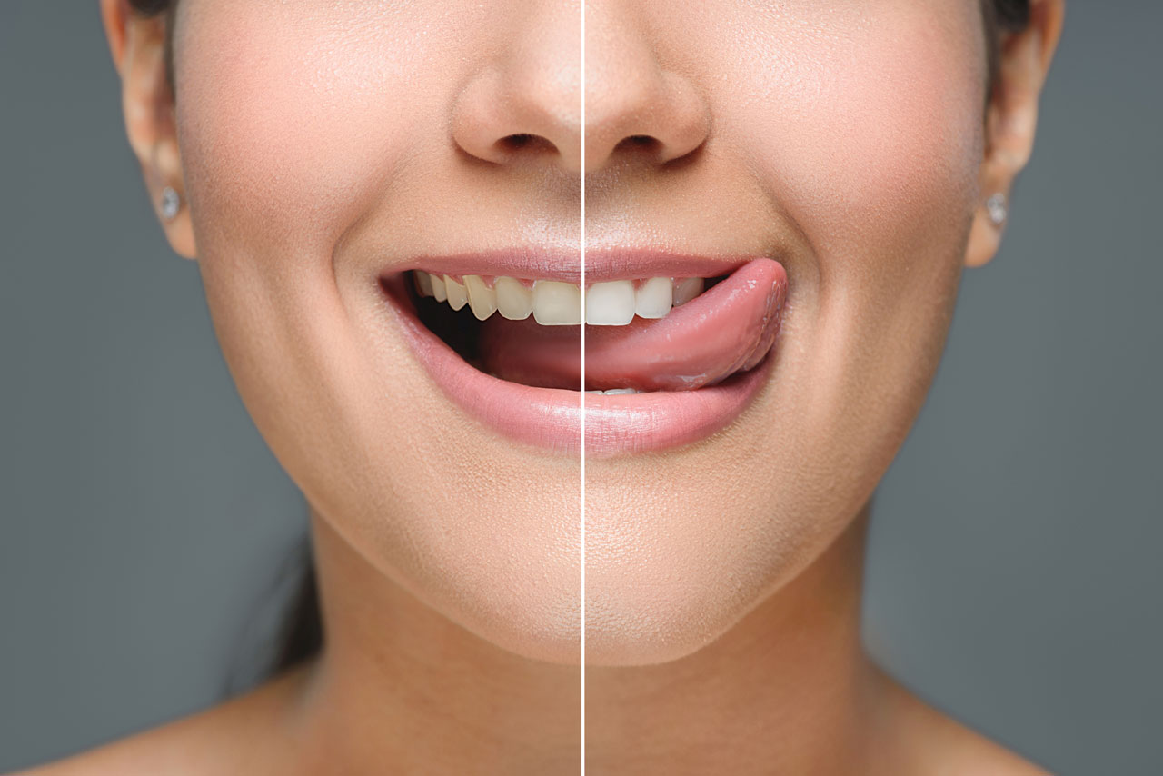 How To Have Happy Teeth-Dental Care Wise