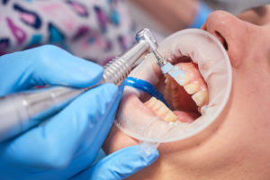 how much does a dental cleaning cost without insurance